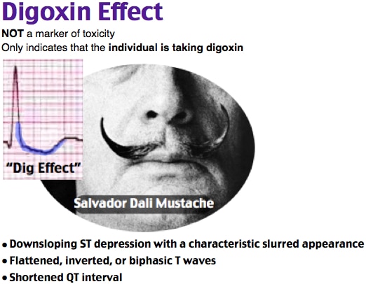 Digoxin effect