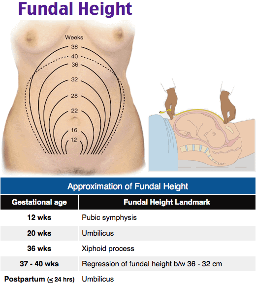 Didactic Qbank Visual Example- Fundal Height