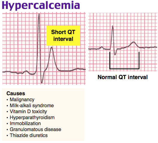 Didactic Qbank Visual Example- Hypercalcemia