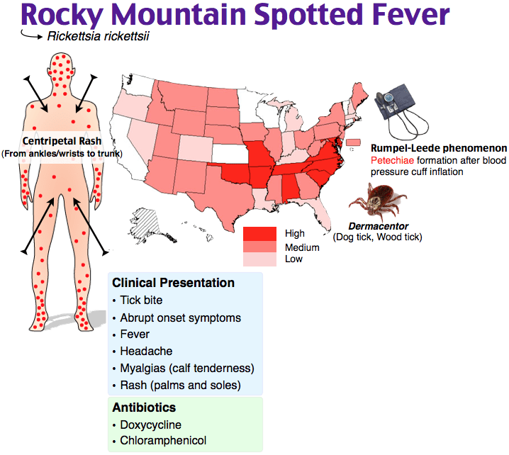 Rocky Mountain spotted fever