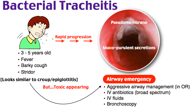 Bacterial tracheitis